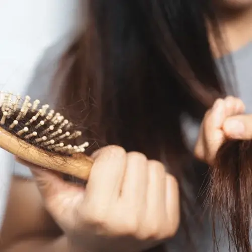 queda de cabelo