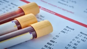 medo de tirar sangue